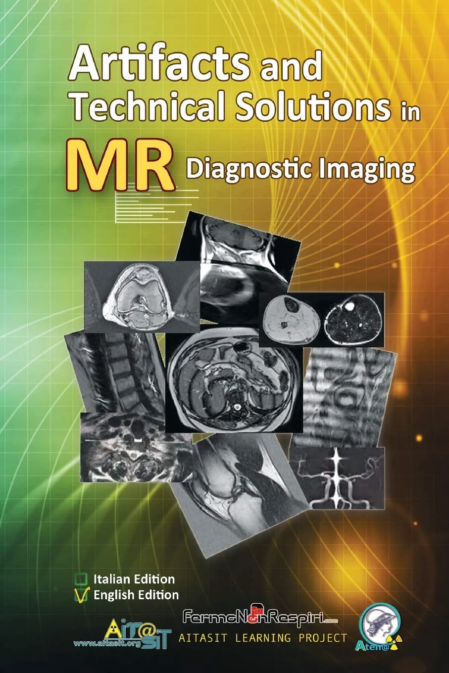 Artifacts and Technical Solutions in MR Diagnostic Imaging - Comprehensive Guide with Visuals