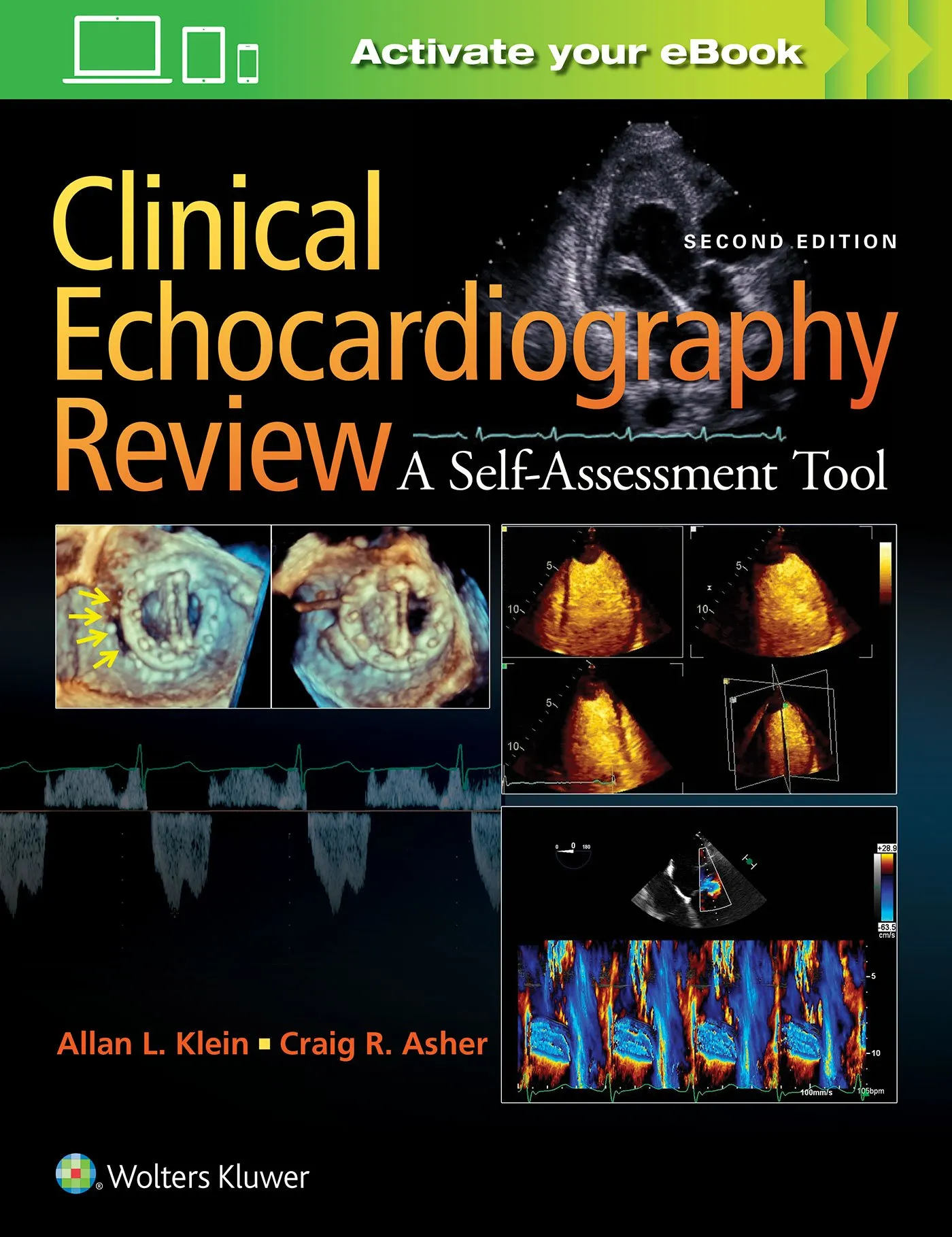 Clinical Echocardiography Review with Over 1100 Self-Assessment Questions and Online Videos