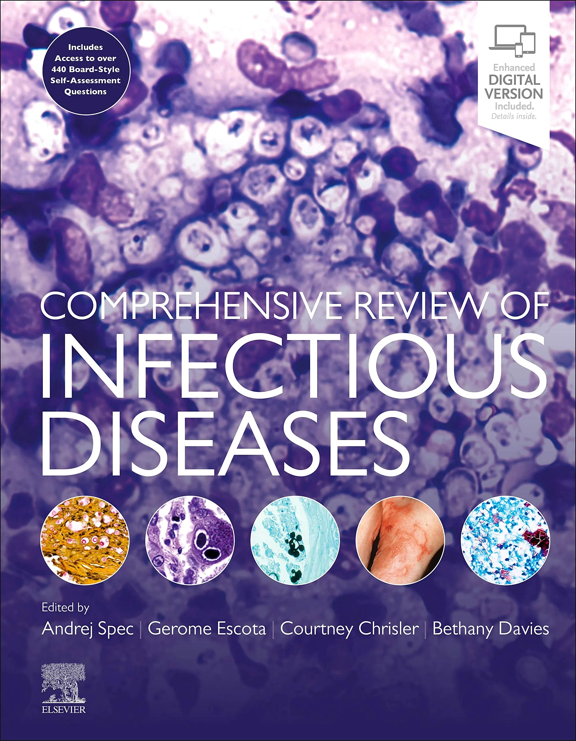 Comprehensive Review of Infectious Diseases: Essential Study Guide for Board Exam Success