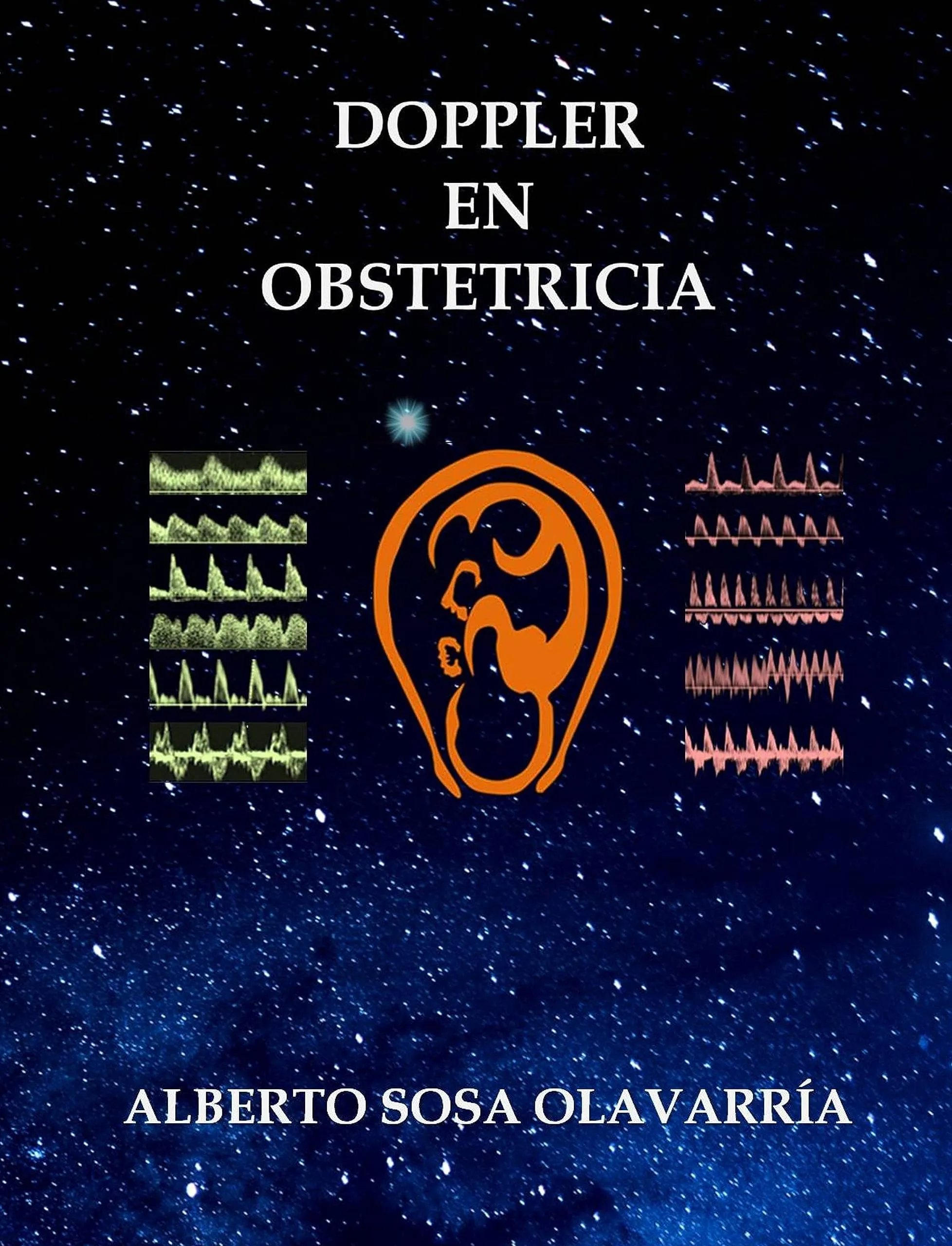 Doppler en Obstetricia - Spanish Edition by Sourcebooks