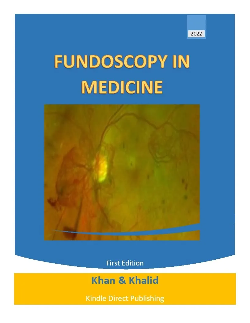 FUNDOSCOPY IN MEDICINE (PEARLS OF MEDICINE) - Essential Insights for Medical Professionals