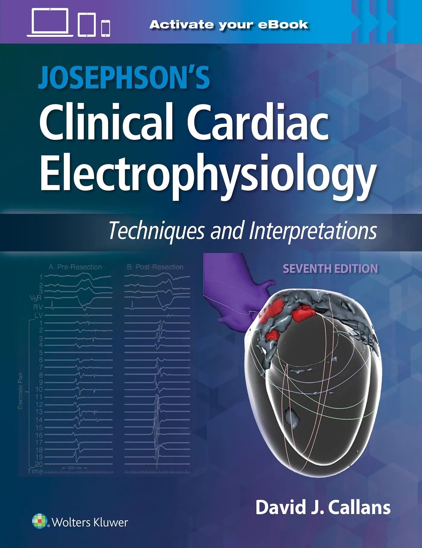 Josephson's Clinical Cardiac Electrophysiology Seventh Edition - Expert Insights and Illustrations