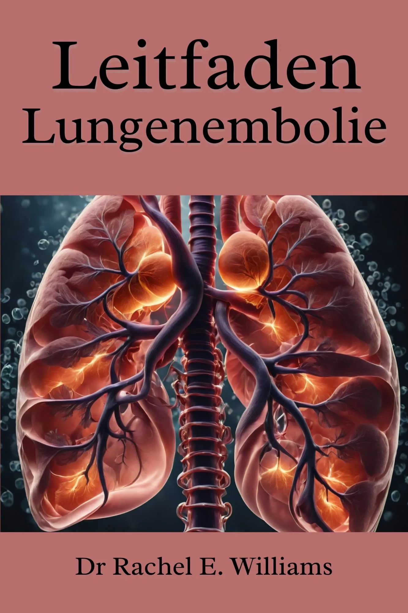 Leitfaden Lungenembolie - Essential Guide to Pulmonary Embolism by Harvard Education Press