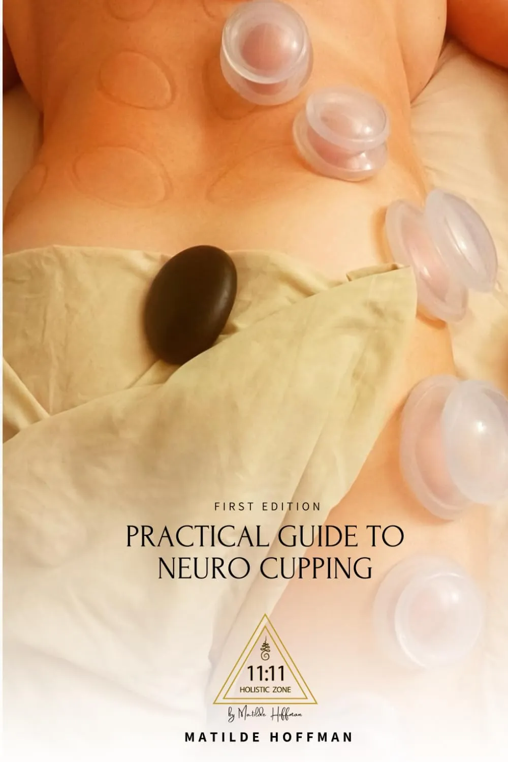 Practical Guide to Neurocupping by Brown Technical Publications Inc. - Essential Techniques