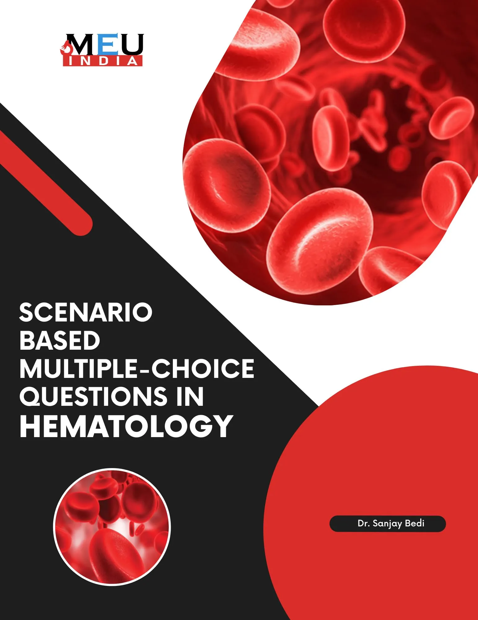 Scenario Based Multiple Choice Questions in Hematology Book by Mometrix